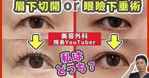 【目の開き】眉下切開と眼瞼下垂術のどちらを選ぶべき？症例写真を付きで比較解説【まぶた（瞼）の整形】