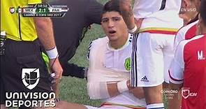 Alan Pulido se fue vendado y con gran dolor tras una lesión de hombro ...¿Se pierde la Copa?