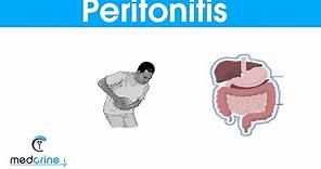 Peritonitis : causes, signs and symptoms and treatment