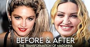 Madonna | Before & After | Plastic Surgery Transformation