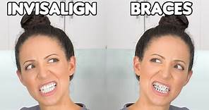 Braces or Invisalign? (Which is BETTER)