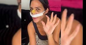 Tamara Gorro enseña como ha quedado su nariz tras su operación de rinoplastia