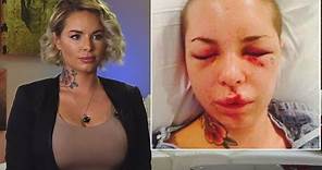 War Machine's Ex, Christy Mack, Opens up About Being Beaten by Former MMA Star