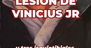 LESIÓN de VINICIUS JR en el BÍCEPS FEMORAL: "Una de las dos más importantes que tiene un FUTBOLISTA"