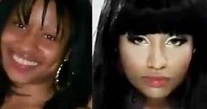 Nicki Minaj Before & After Plastic Surgery [Must Watch]