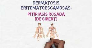 Dermatología - Pitiriasis Rosada (de Gibert o de Gilbert)