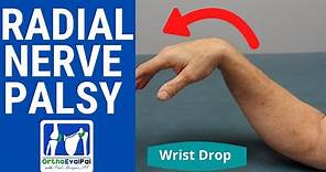 Radial Nerve Palsy (Wrist Drop) Evaluation