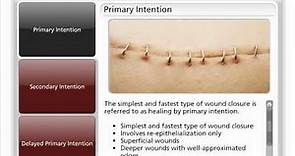 Types of Wound Closure