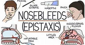 Understanding Nosebleeds (Epistaxis)
