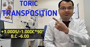 Toric Transposition | How to do Toric Transposition | Transposing Toric Prescription | Transposition