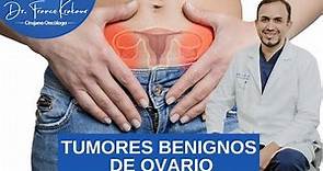 Tumores Benignos de Ovario/ Dr. Franco Krakaur/ Cirujano Oncólogo