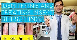 Insect Bites and Stings | Insect Bites Treatment | How to Treat Insect Bites and Stings | 2018