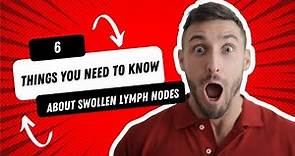 6 things you need to know about swollen lymph nodes (or swollen glands) #SpotLeukaemia