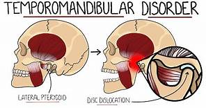 Temporomandibular Joint Disorder Explained (TMJ Dysfunction) | Includes Treatment & Anatomy