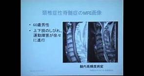 『頚椎疾患の診断と最新治療』 池永 稔 先生