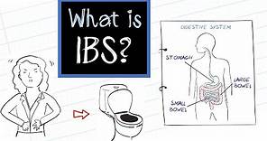 What is IBS? (Irritable Bowel Syndrome)