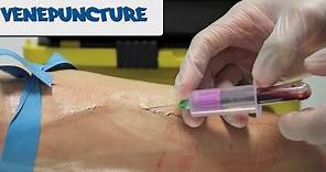 Venipuncture - How to take Blood - OSCE Guide (old version) | UKMLA | CPSA