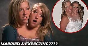 Conjoined Twin Abby Hensel of Abby & Brittany Privately Married Josh Bowling