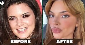 Kendall Jenner's Shocking Plastic Surgery Secrets! | Opt into Beauty