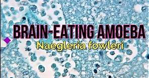 Brain-Eating Amoeba: Naegleria fowleri