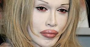 The Tragedy Of Pete Burns Is Simply Heartbreaking