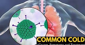 Common Cold, Causes, Signs and Symptoms, Diagnosis and Treatment.