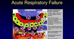 PPT - Chapter 9 Acute Respiratory Failure PowerPoint Presentation, free download - ID:6391555