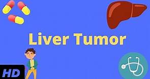 Liver Tumor, Causes, Signs and Symptoms, Diagnosis and Treatment.