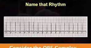 Introduction to EKG Rhythm Interpretation (Part 2)