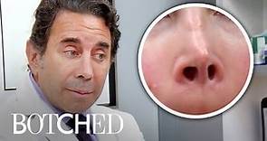 Most AMAZING Nose & Skin Surgeries From Dr. Paul Nassif | Botched | E!