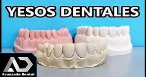 Tipos De Yeso Dentales (Odontología) miniClase