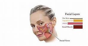 Facelift Anatomy | How Face Lifts work | Aesthetic Minutes #Facelift #Anatomy