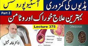 Weak bones and Osteoporosis , Best treatment with Diet and Vitamins | lecture 375 , Part 2