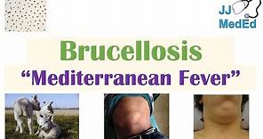 Brucellosis (Mediterranean Fever) | Transmission, Pathogenesis, Symptoms, Diagnosis, Treatment