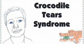Crocodile Tears | Bogorad Syndrome| Explained