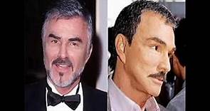 Burt Reynolds plastic surgery