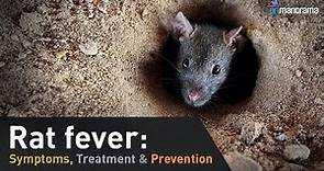 Rat fever: Symptoms, Treatment & Prevention
