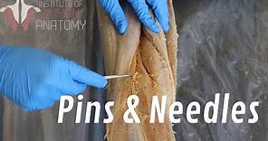 What Are "Pins & Needles"??
