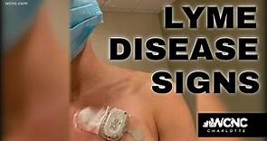 Do you know the signs of Lyme disease?