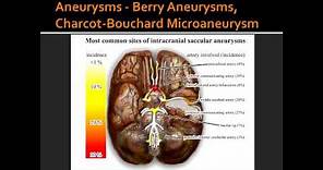 Aneurysms - Berry Aneurysms, Charcot-Bouchard Microaneurysm