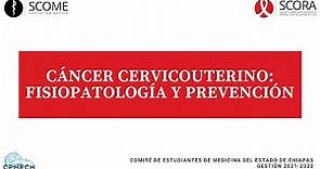 Cáncer Cervicouterino: Fisiopatología y prevención