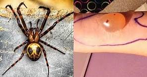 MOST Venomous Spiders On Earth!