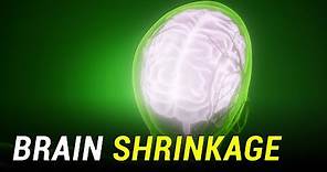 Why Your Brain is Shrinking?