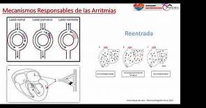 12 - Extrasístoles auriculares y ventriculares
