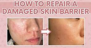 How to Heal a Damaged Skin Barrier 101 | Tips to Repair a Damaged Moisture Barrier