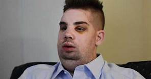 Mitch Hunter Describes His Face Transplant Video - Brigham and Women's Hospital