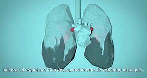 OMS: Respira la Vida - Cómo la contaminación del aire afecta a tu cuerpo