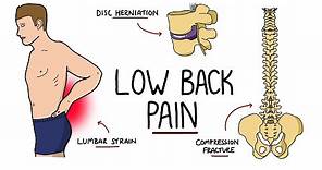 Low Back Pain Explained (Including Red Flags)