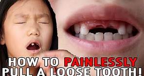 How To Pull A Loose Tooth | No Cry Teeth Pulling Method | Easily Extract Baby Teeth