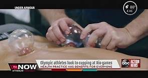 Olympic athletes look to cupping at Rio games